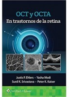 OCT Y OCTA EN TRASTONRNOS DE LA RETINA