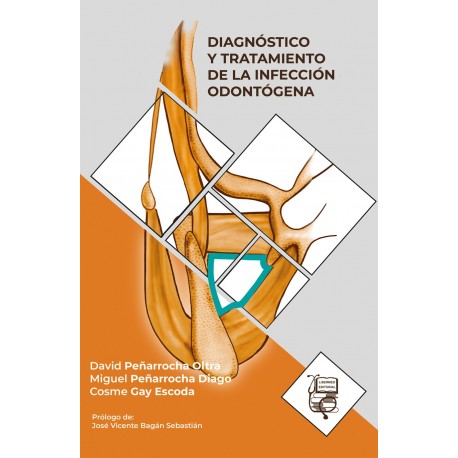 DIAGNOSTICO Y TRATAMIENTO DE LA INFECCION ODONTOGENA
