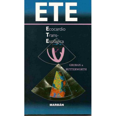 ECOCARDIO TRANS-ESOFAGICA. ESPIRAL