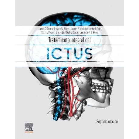 TRATAMIENTO INTEGRAL DEL ICTUS