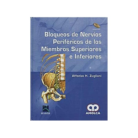 BLOQUEOS DE NERVIOS PERIFERICOS DE LOS MIEMBROS SUPERIORES E INFERIORES