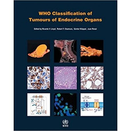 WHO CLASSIFICATION OF TUMOURS OF ENDOCRINE ORGANS