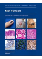 WHO CLASSIFICATION OF TUMOURS: SKIN TUMOURS