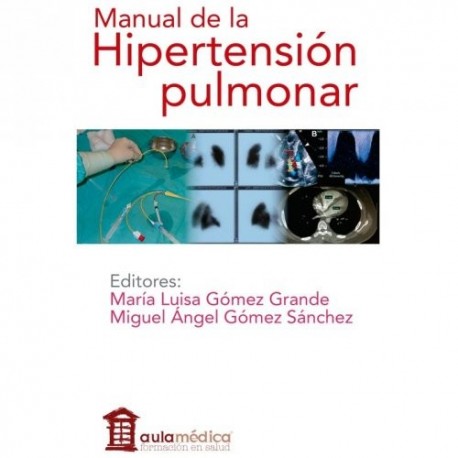 MANUAL DE HIPERTENSION PULMONAR