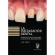 LA PREPARACION DENTAL. PREPARACION DE DIENTES PARA EL EXITO DE LAS RESTAURACIONES