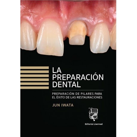 LA PREPARACION DENTAL. PREPARACION DE DIENTES PARA EL EXITO DE LAS RESTAURACIONES