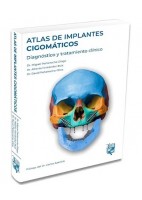 ATLAS DE IMPLANTES CIGOMATICOS. DIAGNOSTICO Y TRATAMIENTO CLINICO