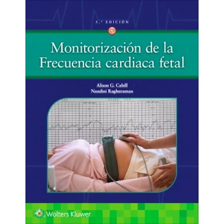 MONITORIZACION DE LA FRECUENCIA CARDIACA FETAL