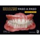 SISTEMA DE PROTESIS BIOFUNCIONAL (BPS)® PASO A PASO