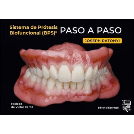 SISTEMA DE PROTESIS BIOFUNCIONAL (BPS)® PASO A PASO