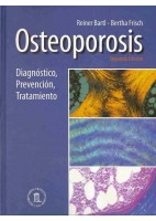 OSTEOPOROSIS. DIAGNOSTICO, PREVENCION, TRATAMIENTO