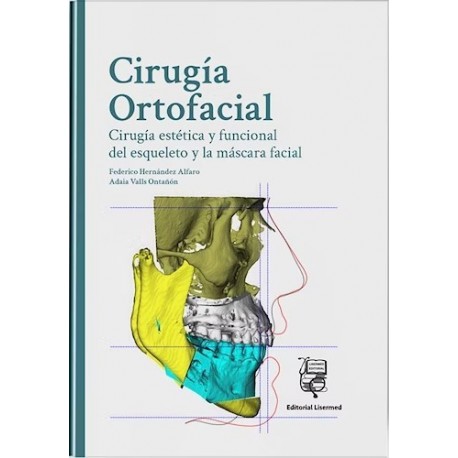 CIRUGIA ORTOFACIAL. CIRUGIA ESTETICA Y FUNCIONAL DEL ESQUELETO Y LA MASCARA FACIAL