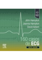 160 CASOS DE ECG