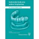 SOBREDENTADURAS SOBRE IMPLANTES. MANUAL CLINICO