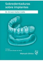 SOBREDENTADURAS SOBRE IMPLANTES. MANUAL CLINICO