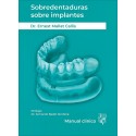SOBREDENTADURAS SOBRE IMPLANTES. MANUAL CLINICO