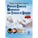 PROTESIS COMPLETA MANDIBULAR CON TECNICA DE SUCCION