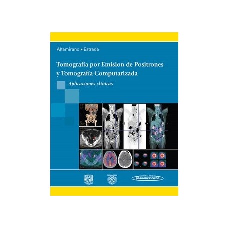 TOMOGRAFIA POR EMISION DE POSITRONES Y TOMOGRAFIA COMPUTARIZADA