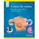 CANCER DE MAMA. BASES CLINICO-MOLECULARES Y MANEJO INTEGRAL