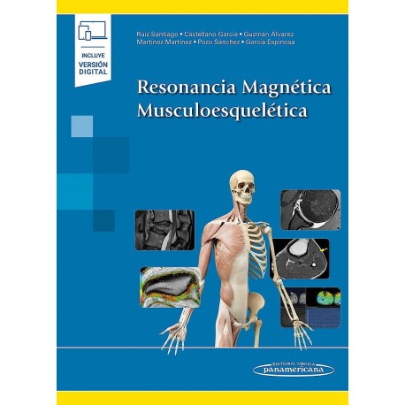RESONANCIA MAGNETICA MUSCULOESQUELETICA (INCLUYE VERSION DIGITAL)