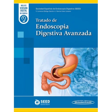 TRATADO DE ENDOSCOPIA DIGESTIVA AVANZADA (INCLUYE VERSION DIGITAL MI EUREKA)