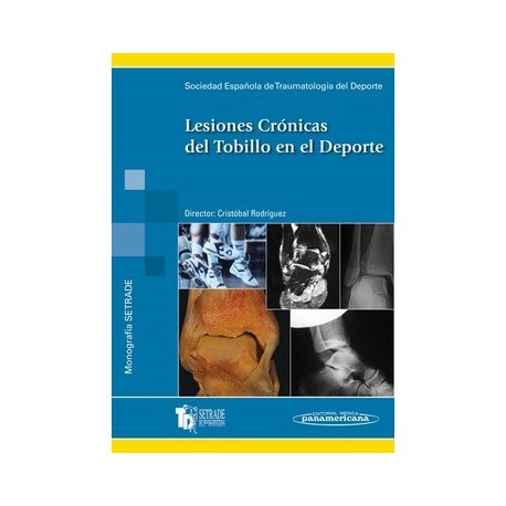LESIONES CRONICAS DEL TOBILLO EN EL DEPORTE (MONOGRAFIAS SETRADE)