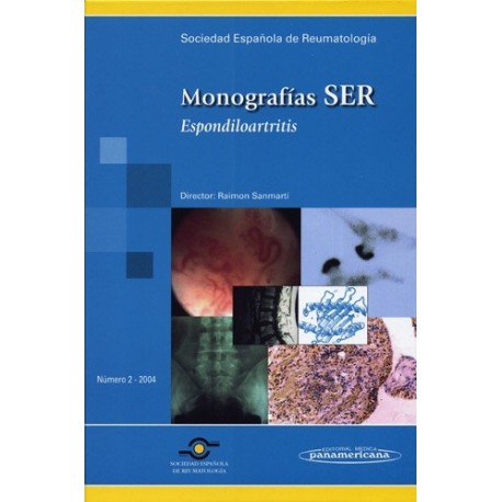 MONOGRAFIAS SER. ESPONDILOARTRITIS