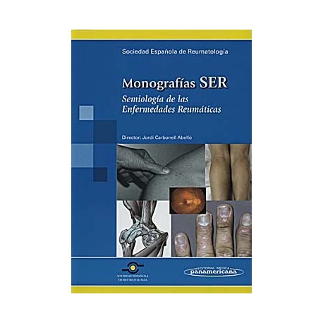 SEMIOLOGIA DE LAS ENFERMEDADES REUMATICAS. MONOGRAFIAS SER