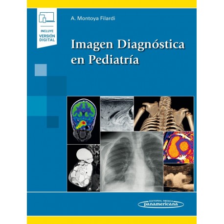 IMAGEN DIAGNOSTICA EN PEDIATRIA (INCLUYE VERSION DIGITAL)