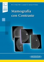 MAMOGRAFIA CON CONTRASTE (INCLUYE VERSION DIGITAL)