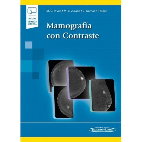 MAMOGRAFIA CON CONTRASTE (INCLUYE VERSION DIGITAL)