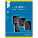 MAMOGRAFIA CON CONTRASTE (INCLUYE VERSION DIGITAL)