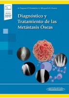 DIAGNOSTICO Y TRATAMIENTO DE LAS METASTASIS OSEAS (INCLUYE VERSION DIGITAL)