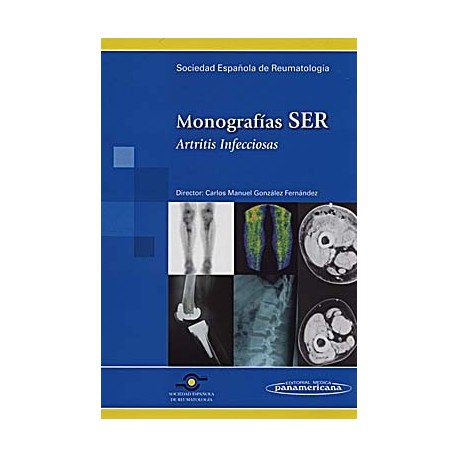 MONOGRAFIAS SER. ARTRITIS INFECCIOSAS