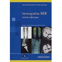 MONOGRAFIAS SER. ARTRITIS INFECCIOSAS