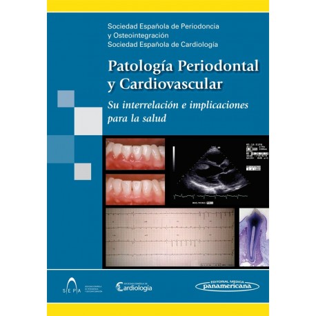 PATOLOGIA PERIODONTAL Y CARDIOVASCULAR. SU INTERRELACION E IMPLICACIONES PARA LA SALUD