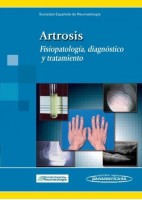 ARTROSIS. FISIOPATOLOGIA, DIAGNOSTICO Y TRATAMIENTO
