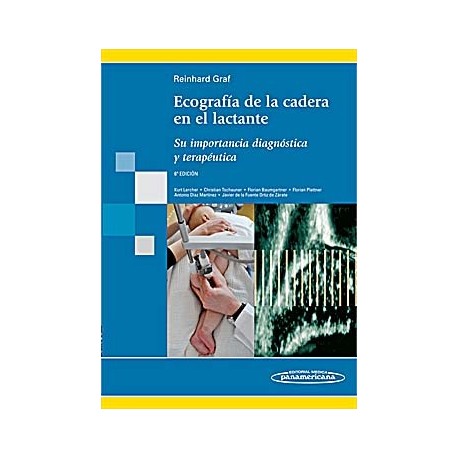 ECOGRAFIA DE LA CADERA EN EL LACTANTE