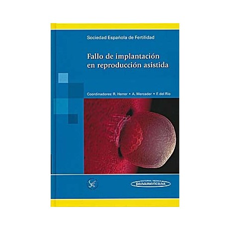 FALLO DE IMPLANTACION EN REPRODUCCION ASISTIDA