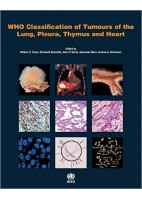 WHO CLASSIFICATION OF TUMOURS OF THE LUNG PLEURA THYMUS AND HEART