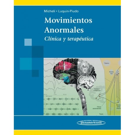 MOVIMIENTOS ANORMALES. CLINICA Y TERAPEUTICA