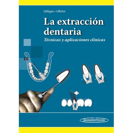 LA EXTRACCION DENTARIA. TECNICAS Y APLICACIONES TECNICAS