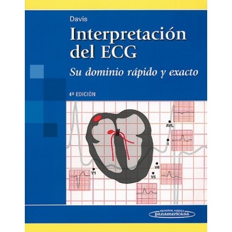 INTERPRETACION DEL ECG