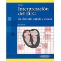 INTERPRETACION DEL ECG