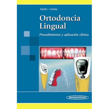 ORTODONCIA LINGUAL. PROCEDIMIENTOS Y APLICACION CLINICA