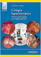 CIRUGIA LAPAROSCOPICA.TECNICA QUIRURGICA EN CIRUGIA GENERAL (INCLUYE VERSION DIGITAL)