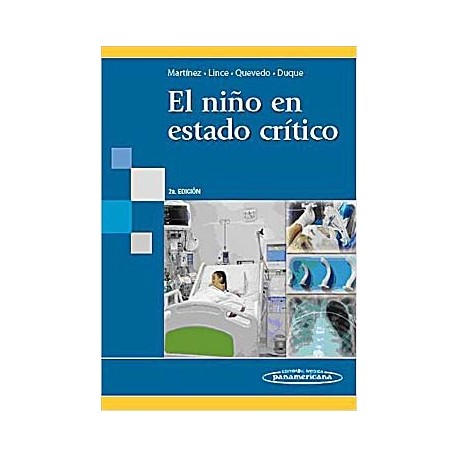 EL NIÃ O EN ESTADO CRITICO