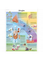ALERGIAS (VR-3660)