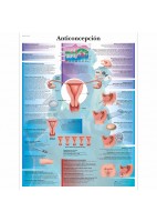 ANTICONCEPCION (VR-3951)