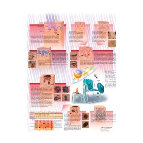 CANCER DE PIEL (VR-3294)